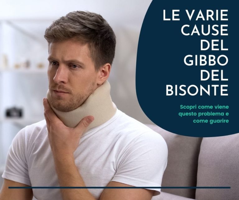 Gobba di bisonte - Come farlo sparire con la fisioterapia giusta